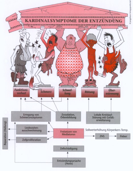Kardinalsymptome von Entzündungen: Rubor, Calor, Dolor, Tumor, Function laesa